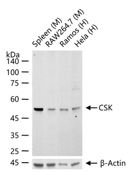 CSK Recombinant Rabbit Monoclonal Antibody