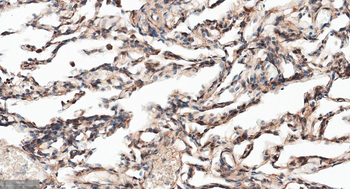 APPL1 Recombinant Rabbit Monoclonal Antibody