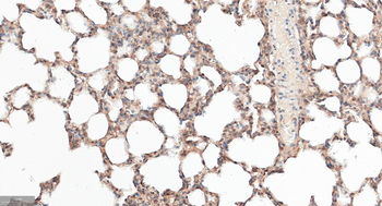 APPL1 Recombinant Rabbit Monoclonal Antibody