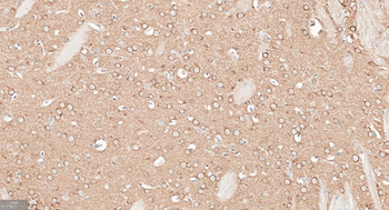 APPL1 Recombinant Rabbit Monoclonal Antibody