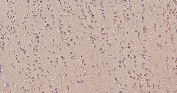 Glucose 6 phosphate isomerase Recombinant Rabbit Monoclonal Antibody