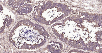 Glucose 6 phosphate isomerase Recombinant Rabbit Monoclonal Antibody