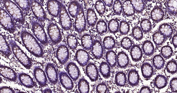 Glucose 6 phosphate isomerase Recombinant Rabbit Monoclonal Antibody