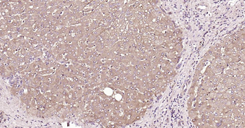 Glucose 6 phosphate isomerase Recombinant Rabbit Monoclonal Antibody