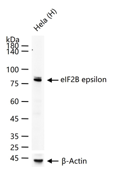 EIF2B epsilon Recombinant Rabbit Monoclonal Antibody