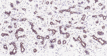 EIF2B epsilon Recombinant Rabbit Monoclonal Antibody