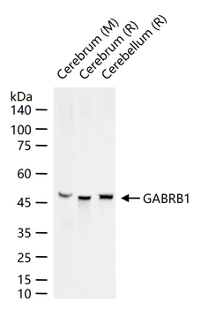 GABRB1 Recombinant Rabbit Monoclonal Antibody