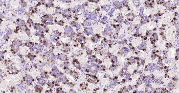 FSH beta Recombinant Rabbit Monoclonal Antibody