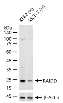 RAIDD Recombinant Rabbit Monoclonal Antibody