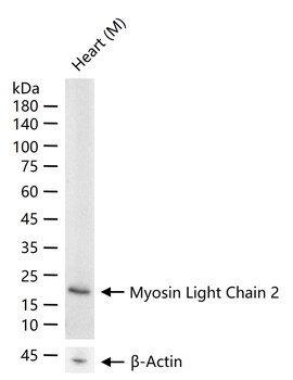 Myosin Light Chain 2 Recombinant Rabbit Monoclonal Antibody
