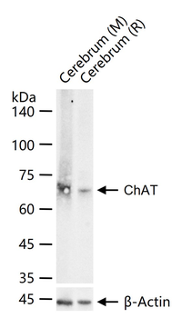 ChAT Recombinant Rabbit Monoclonal Antibody