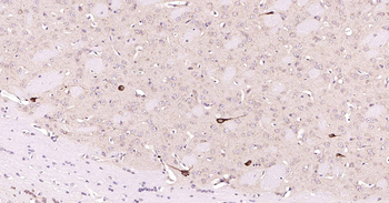 ChAT Recombinant Rabbit Monoclonal Antibody