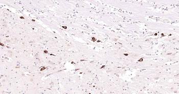 ChAT Recombinant Rabbit Monoclonal Antibody