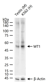 WT1 Recombinant Rabbit Monoclonal Antibody