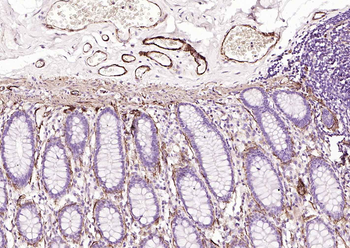 Caldesmon/CDM Recombinant Rabbit Monoclonal Antibody