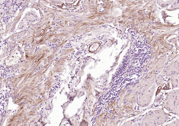 Caldesmon/CDM Recombinant Rabbit Monoclonal Antibody