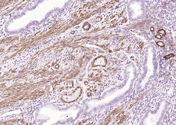 Caldesmon/CDM Recombinant Rabbit Monoclonal Antibody