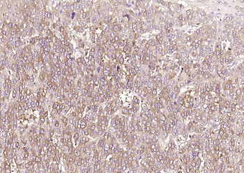 TFRC Rabbit Polyclonal Antibody