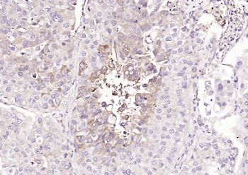 TFRC Rabbit Polyclonal Antibody