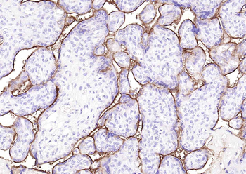 TFRC Rabbit Polyclonal Antibody