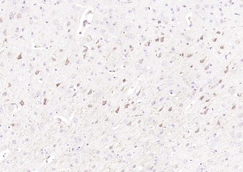 TFRC Rabbit Polyclonal Antibody