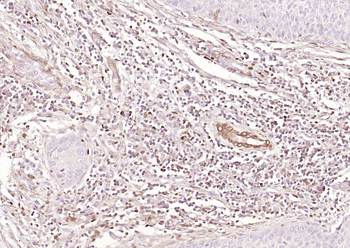 S100A4 Mouse Monoclonal Antibody