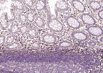 S100A4 Mouse Monoclonal Antibody