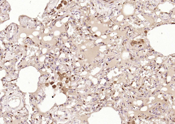 S100A4 Mouse Monoclonal Antibody