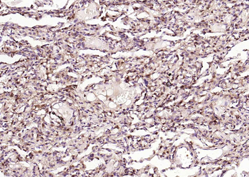 S100A4 Mouse Monoclonal Antibody