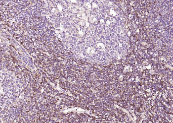 S100A4 Mouse Monoclonal Antibody