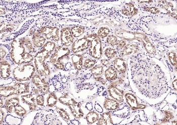 CD26/DPP4 Recombinant Rabbit Monoclonal Antibody