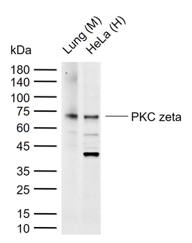 PKC zeta Recombinant Rabbit Monoclonal Antibody