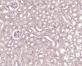 PLA2R Rabbit Polyclonal Antibody