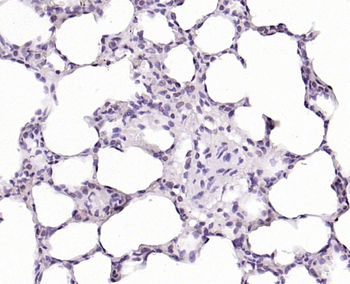 VIPR2 Rabbit Polyclonal Antibody