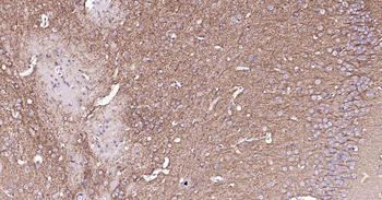 MAP2 Rabbit Polyclonal Antibody