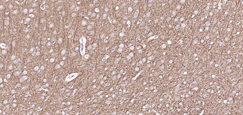 MAP2 Rabbit Polyclonal Antibody