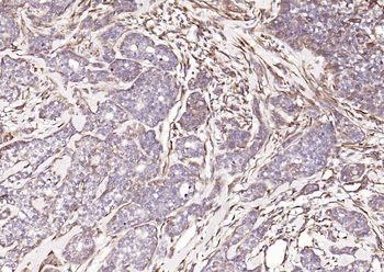 HSP47 Rabbit Polyclonal Antibody