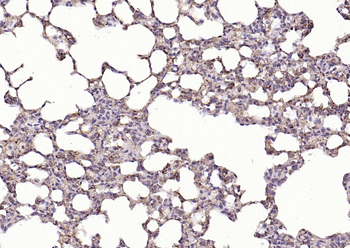 HSP47 Rabbit Polyclonal Antibody