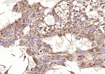 HSP47 Rabbit Polyclonal Antibody
