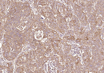 HSP47 Rabbit Polyclonal Antibody