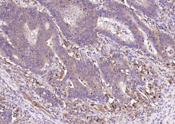 HSP47 Rabbit Polyclonal Antibody