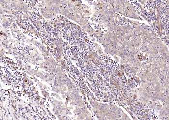 HSP47 Rabbit Polyclonal Antibody