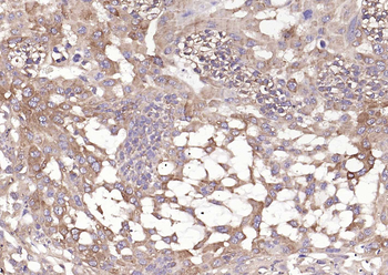 HSP47 Rabbit Polyclonal Antibody