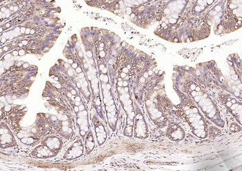 HSP47 Rabbit Polyclonal Antibody