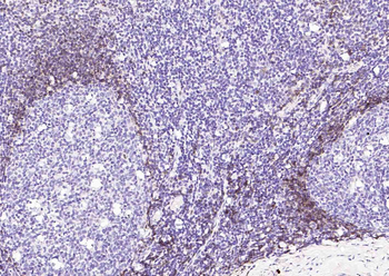 Human IgD Recombinant Rabbit Monoclonal Antibody