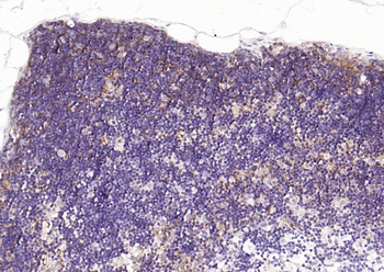 CD1A Recombinant Rabbit Monoclonal Antibody