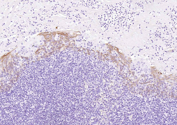 CD1A Recombinant Rabbit Monoclonal Antibody