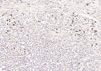 CD80 Mouse Monoclonal Antibody