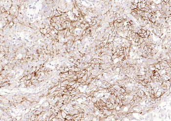 CD138 Recombinant Rabbit Monoclonal Antibody