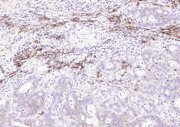 CD138 Recombinant Rabbit Monoclonal Antibody